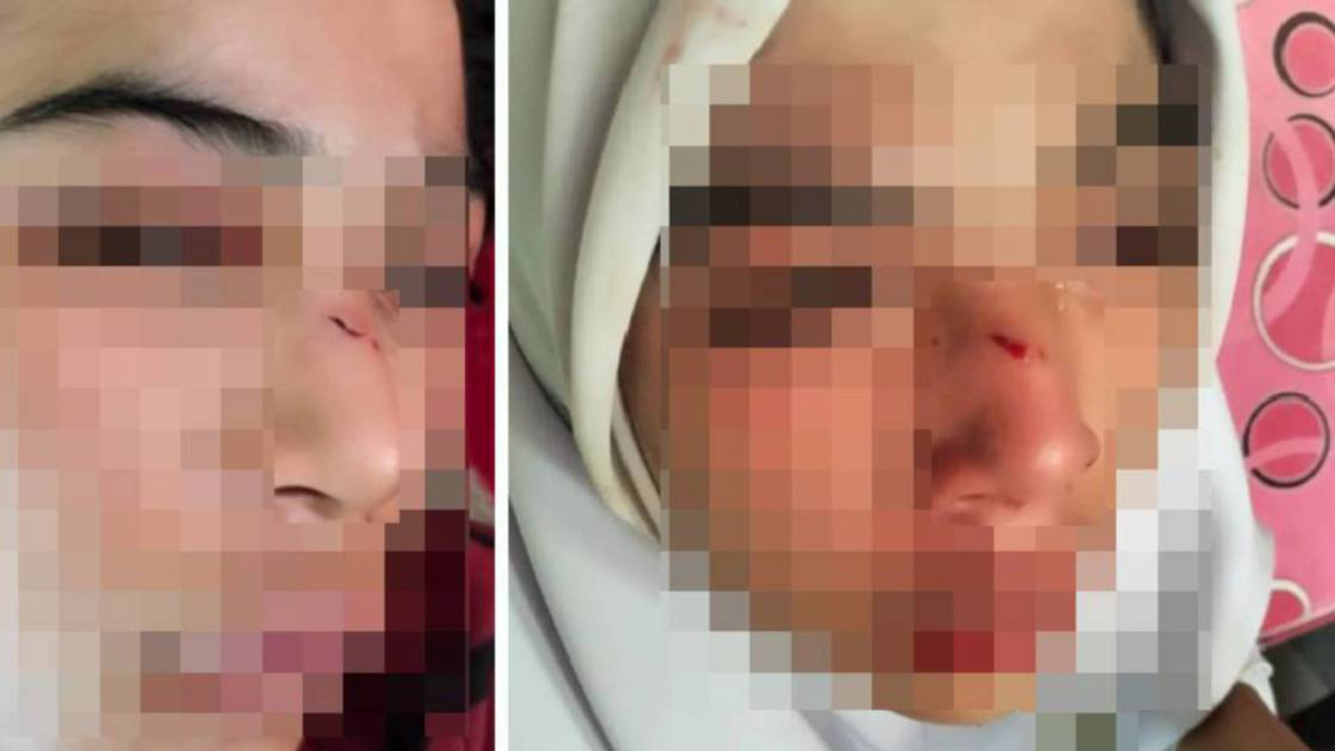 Kelantan Education Department Launches Investigation Into Assault of 15-Year-Old Student