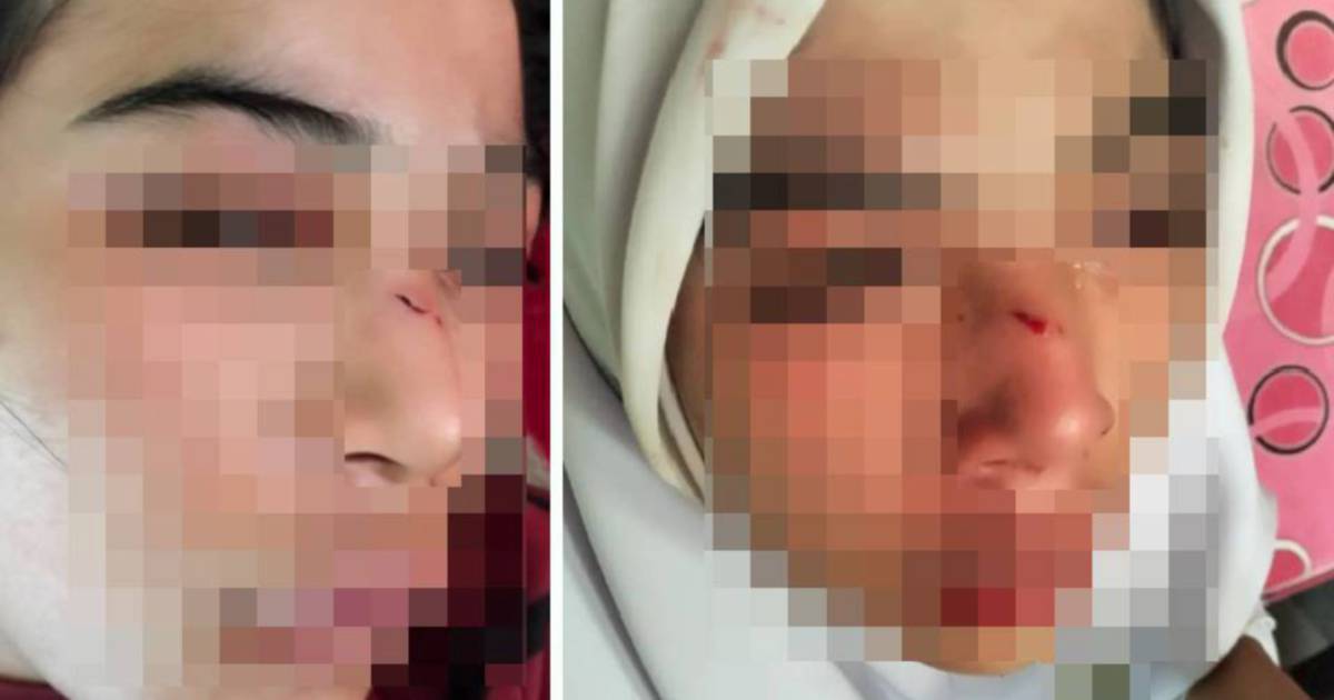 Kelantan Education Department Launches Investigation Into Assault of 15-Year-Old Student