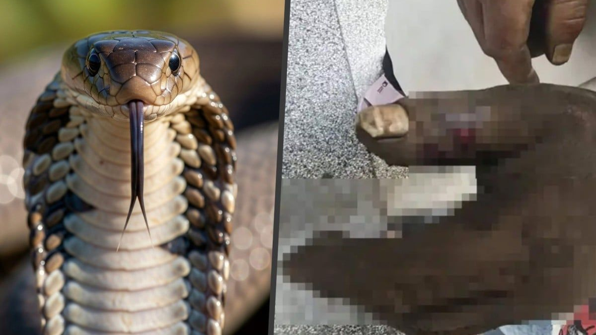 Chinese Wife's Well-Intentioned Cobra Venom Extraction Backfires, Poisoning Herself