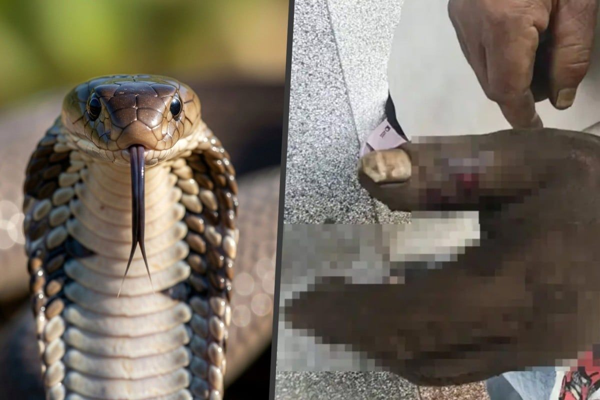 Chinese Wife's Well-Intentioned Cobra Venom Extraction Backfires, Poisoning Herself