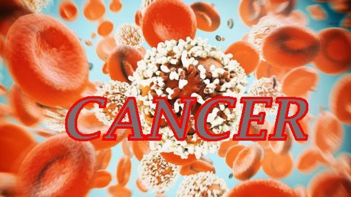 The Alarming Rise of Colorectal Cancer in Young People: What You Need to Know