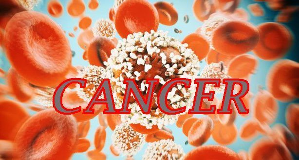 The Alarming Rise of Colorectal Cancer in Young People: What You Need to Know