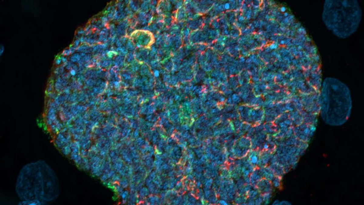 Australian Researchers Develop Breakthrough Malaria Strategy Using Mosquito Bites as Natural Immune Boosters