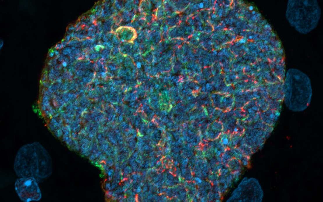 Australian Researchers Develop Breakthrough Malaria Strategy Using Mosquito Bites as Natural Immune Boosters