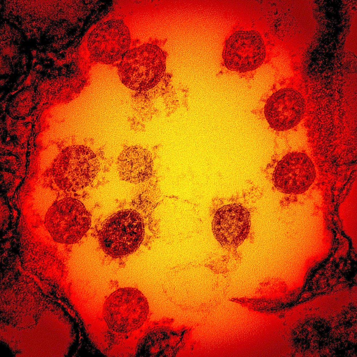 Cambridge Scientists Develop 'Master Key' Vaccine Technology to Combat Virus Families